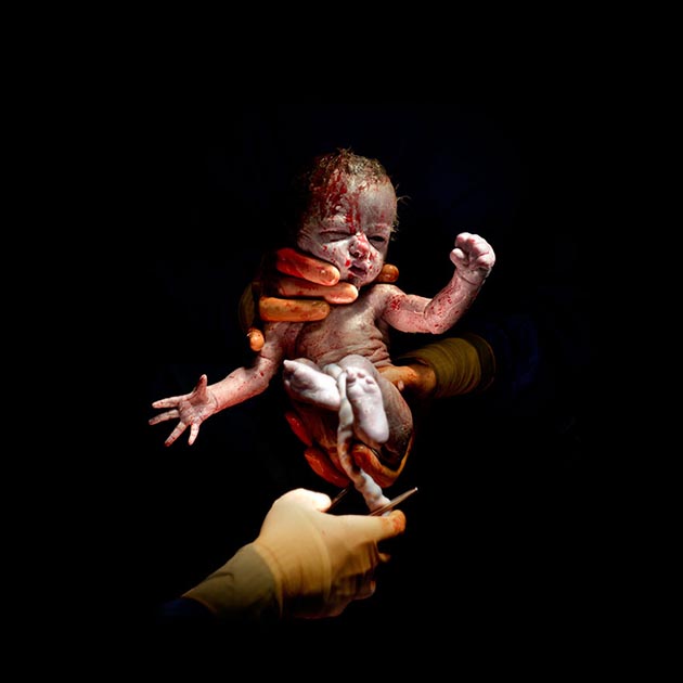 CAESAR #15Leanne - born April 8, 2014 at 8:31 1kg 745 - 13 secon